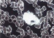 Dunkelfeldmikroskopie